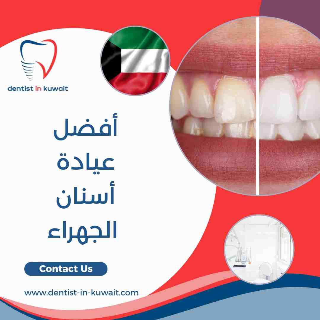 أفضل عيادة أسنان الجهراء