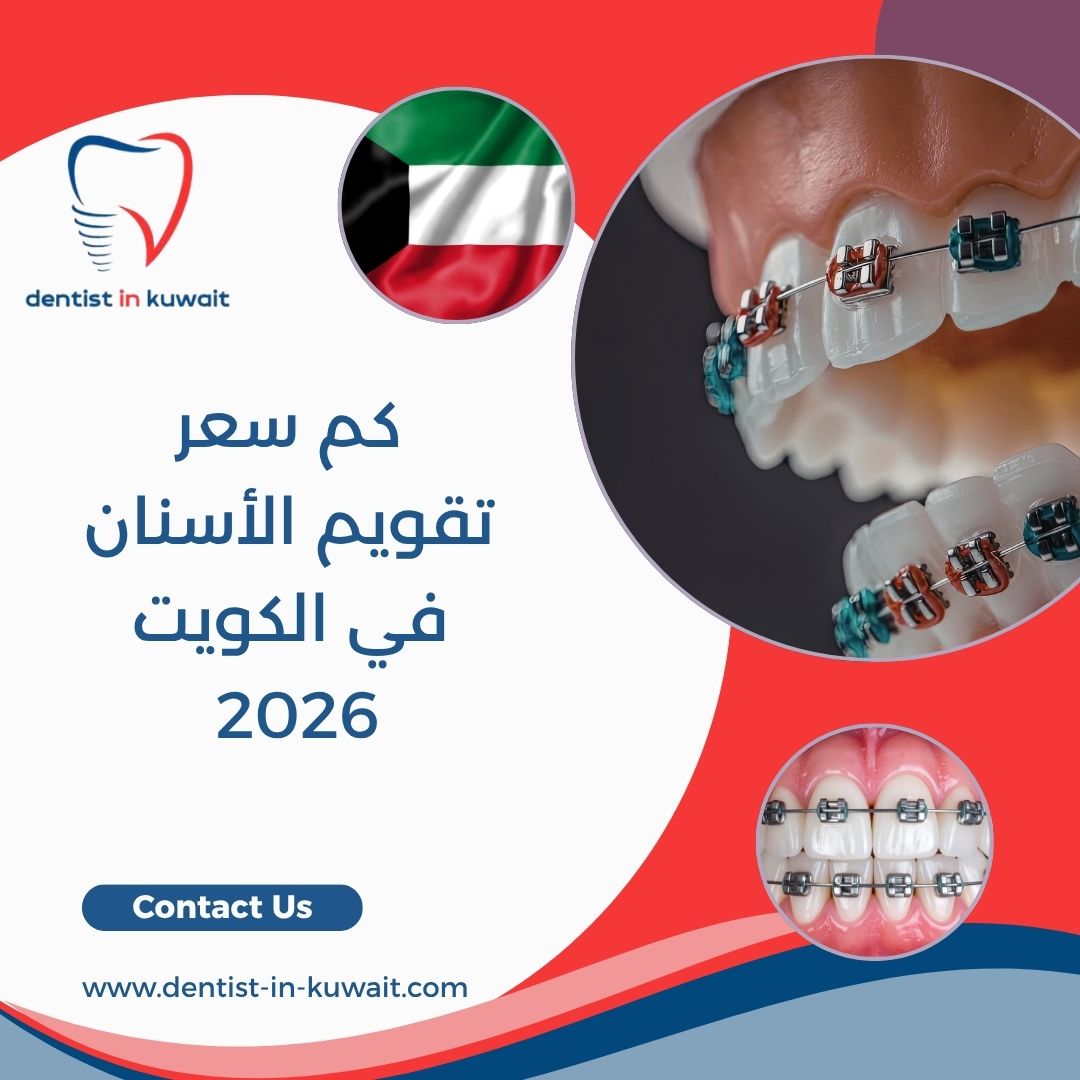 كم سعر تقويم الأسنان في الكويت 2026