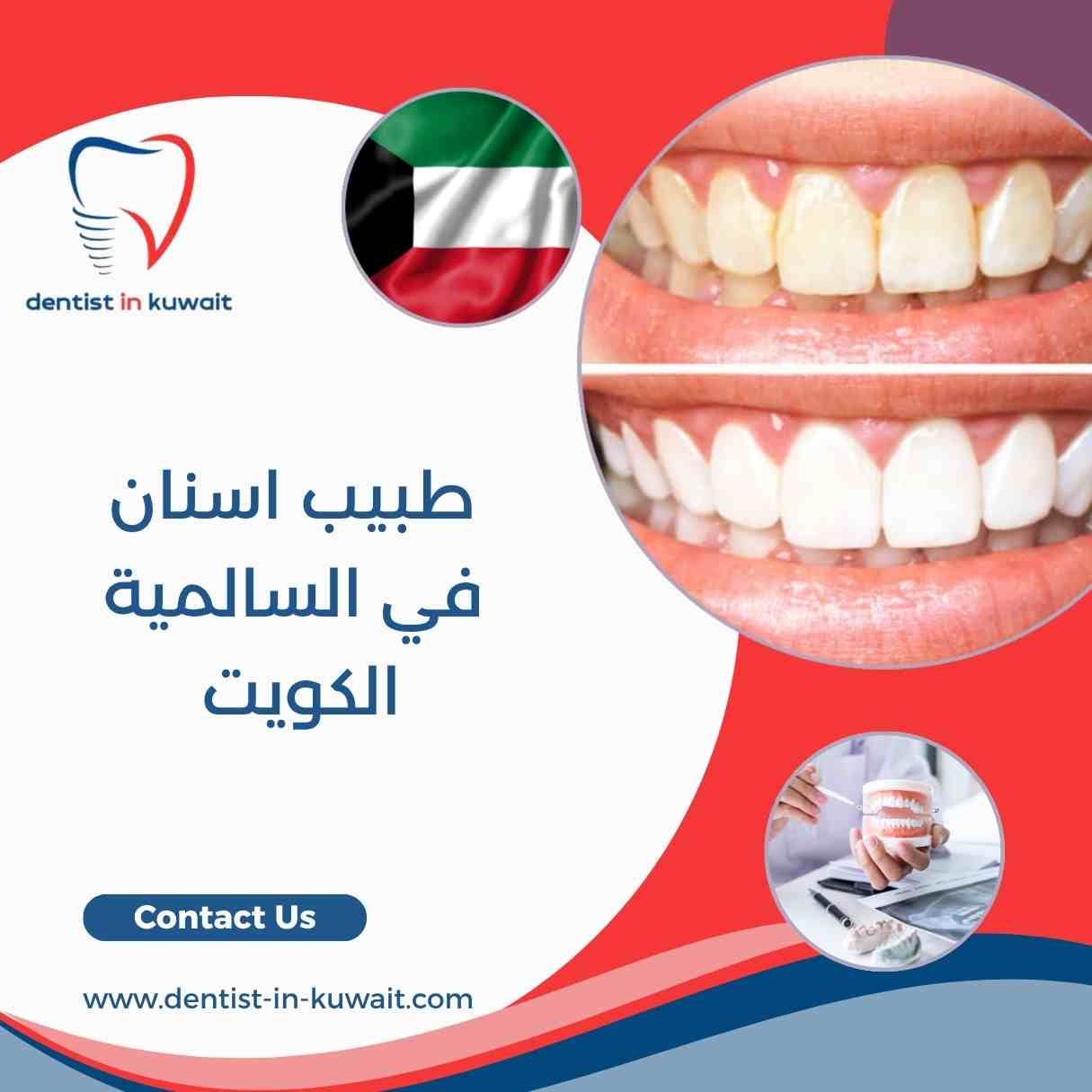 طبيب اسنان في السالمية الكويت
