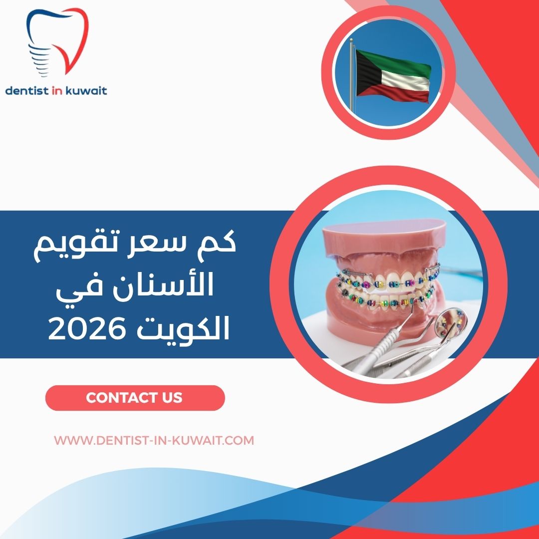 كم سعر تقويم الأسنان في الكويت 2026