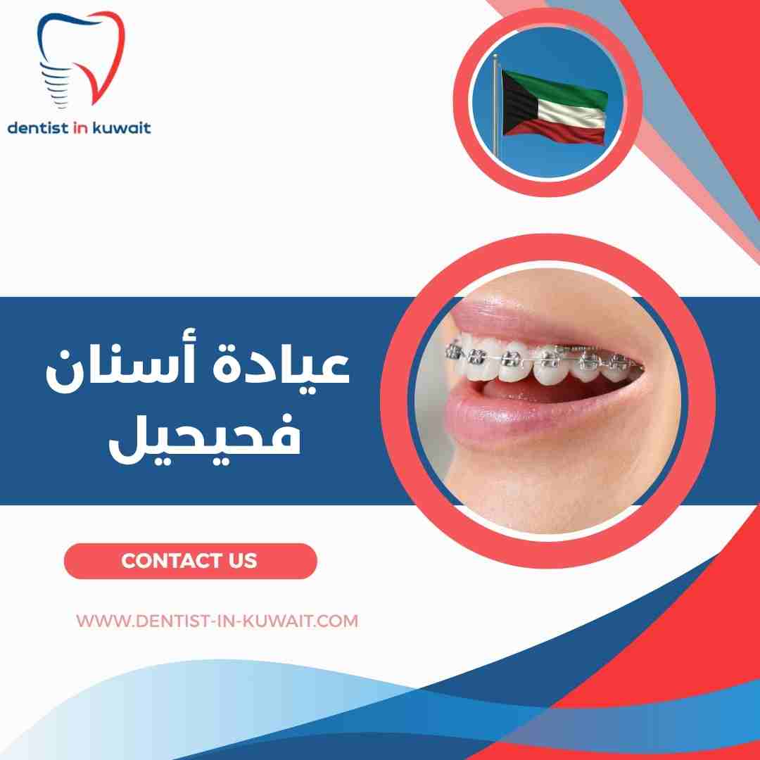 عيادة أسنان فحيحيل