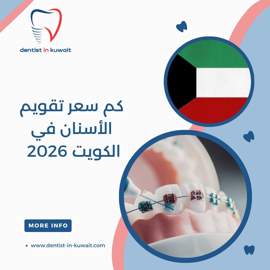 كم سعر تقويم الأسنان في الكويت 2026
