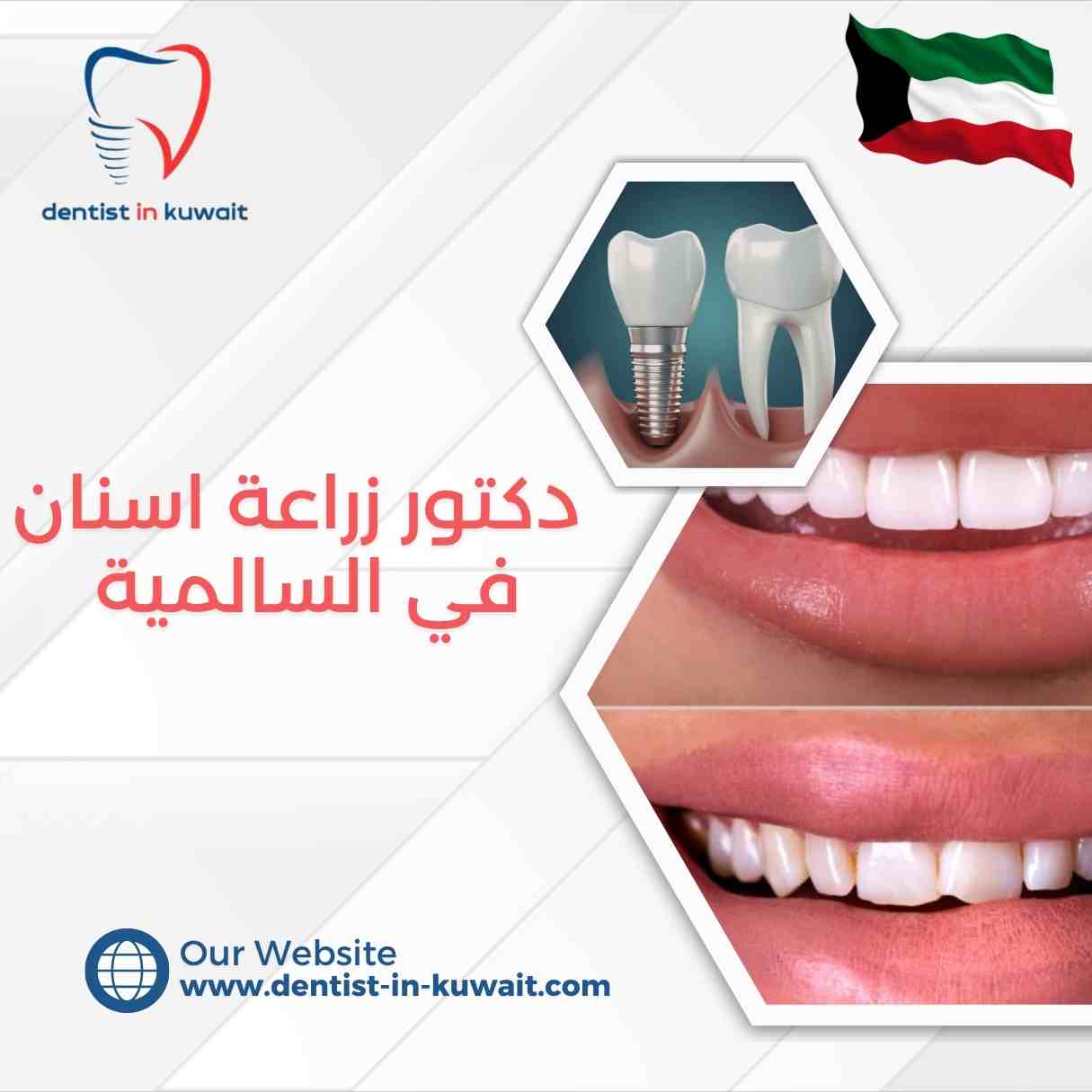 دكتور زراعة اسنان في السالمية