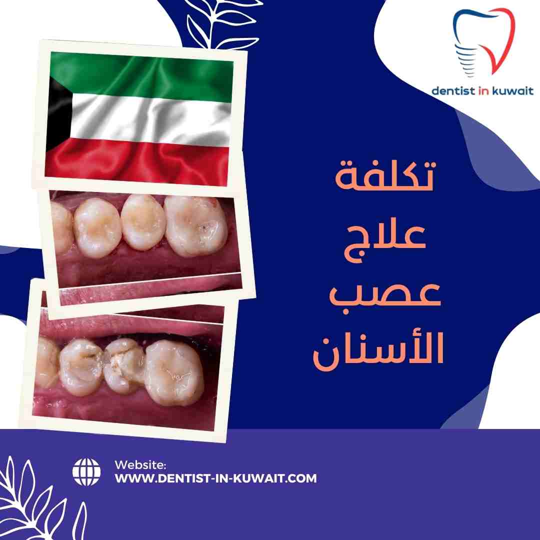 تكلفة علاج عصب الأسنان