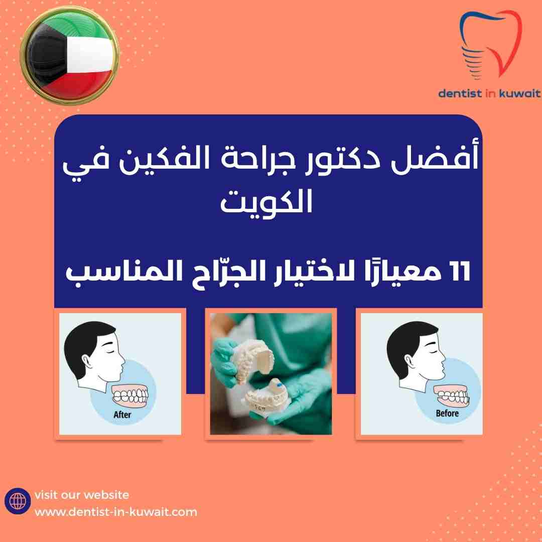 أفضل دكتور جراحة الفكين في الكويت