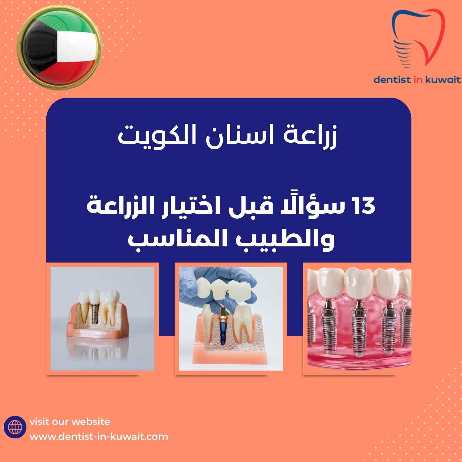 زراعة اسنان الكويت