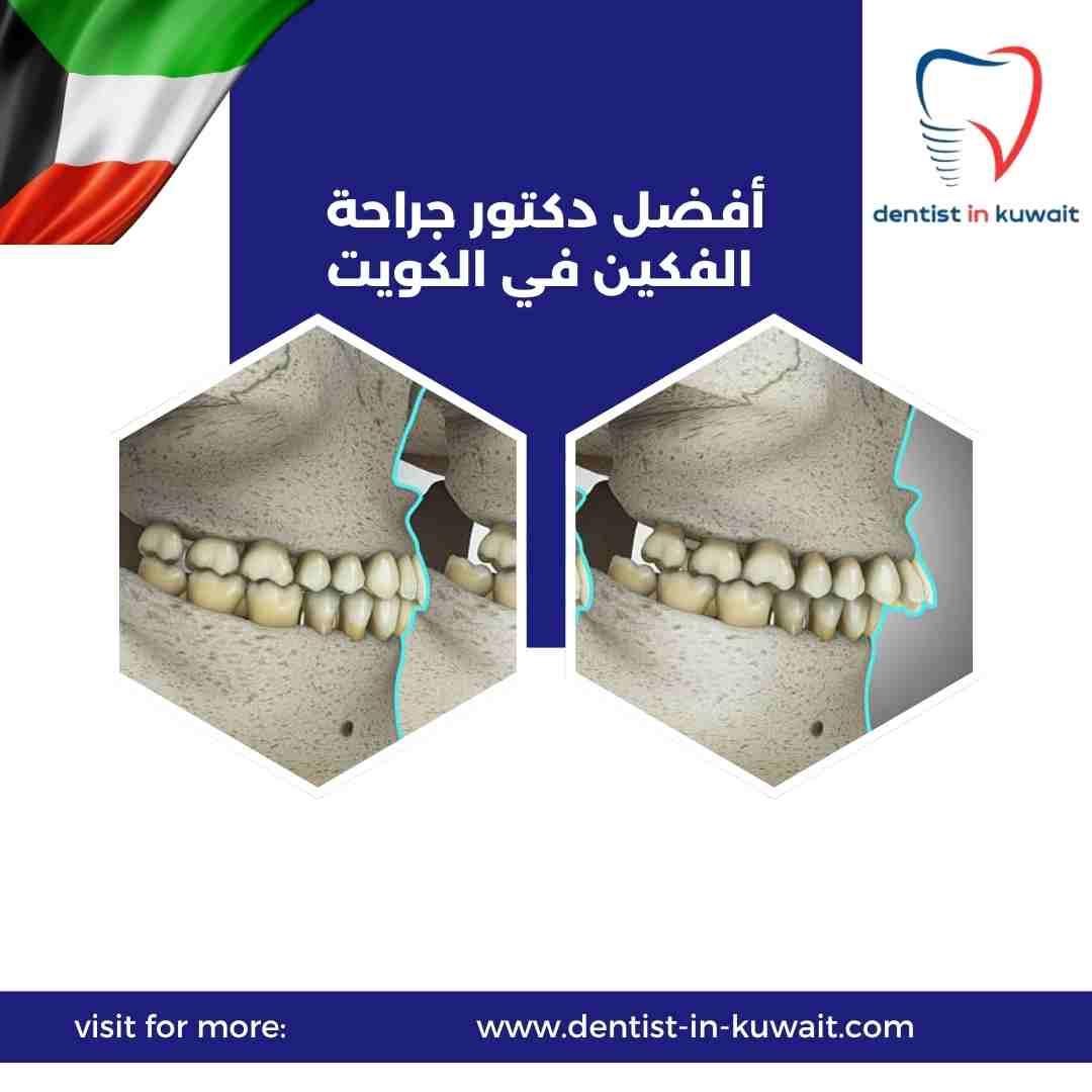 أفضل دكتور جراحة الفكين في الكويت