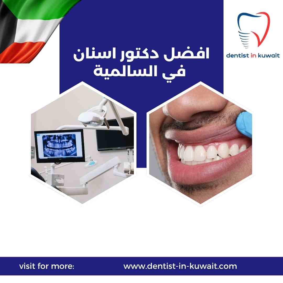 افضل دكتور اسنان في السالمية