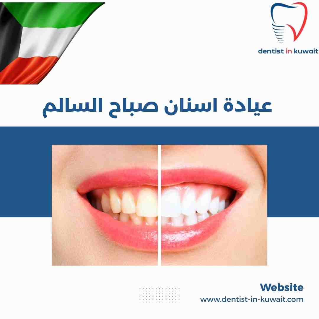 عيادة اسنان صباح السالم