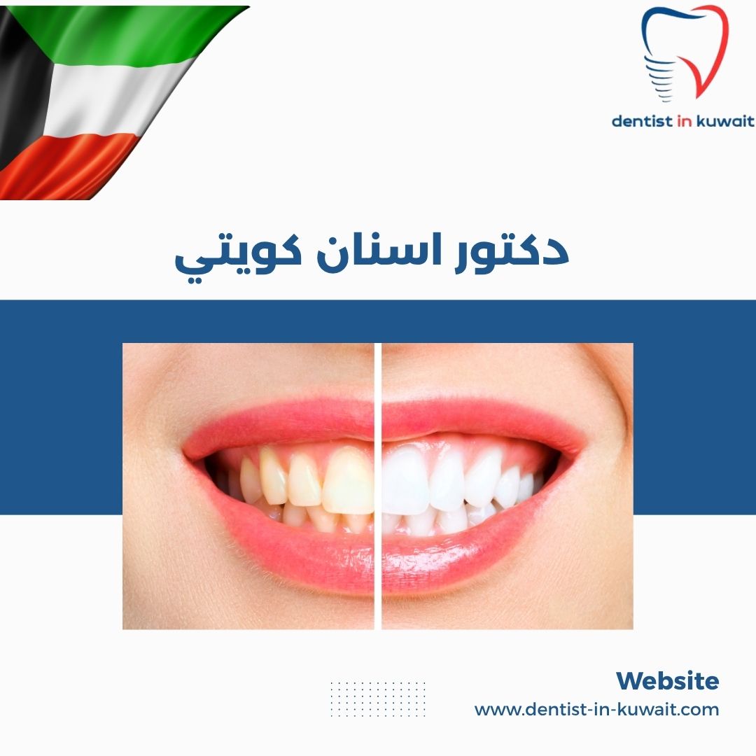دكتور اسنان كويتي