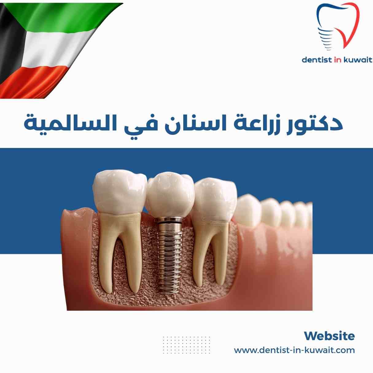 دكتور زراعة اسنان في السالمية