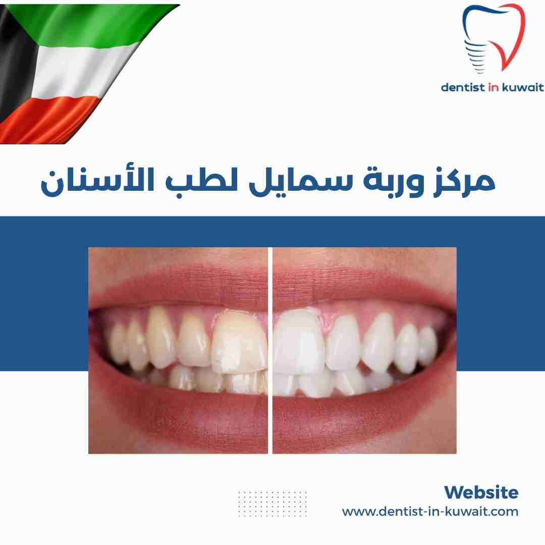 مركز وربة سمايل لطب الأسنان