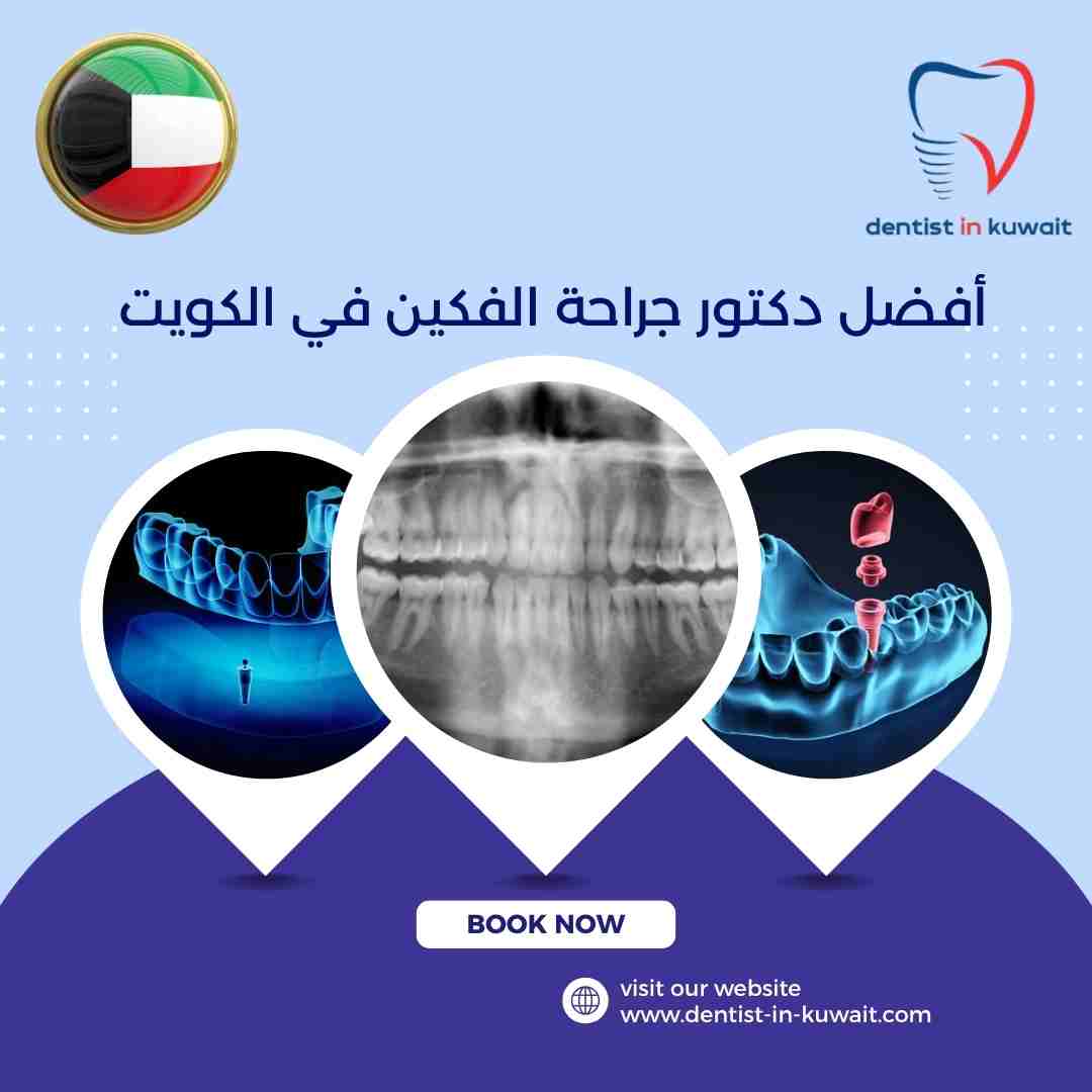 أفضل دكتور جراحة الفكين في الكويت