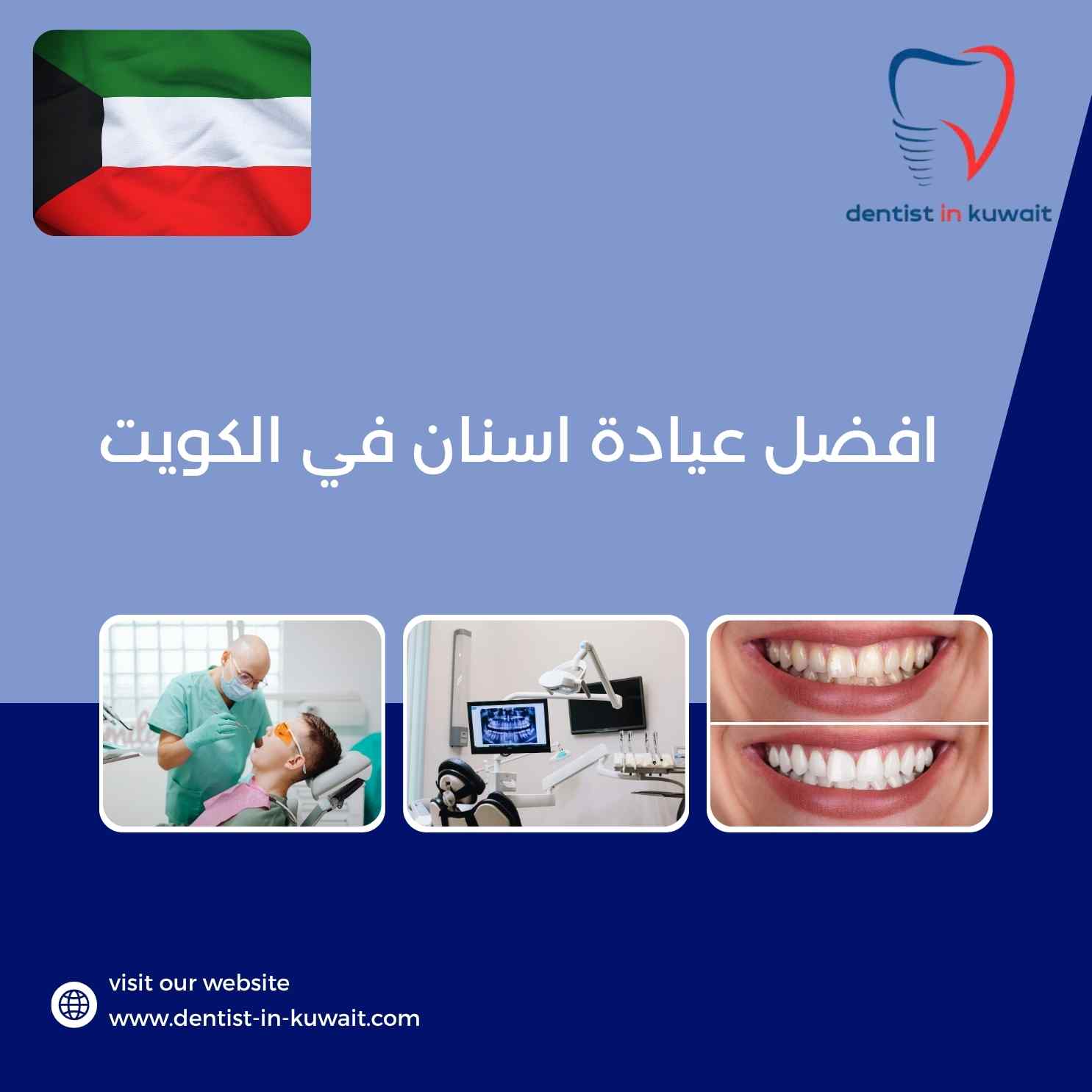 افضل عيادة اسنان في الكويت