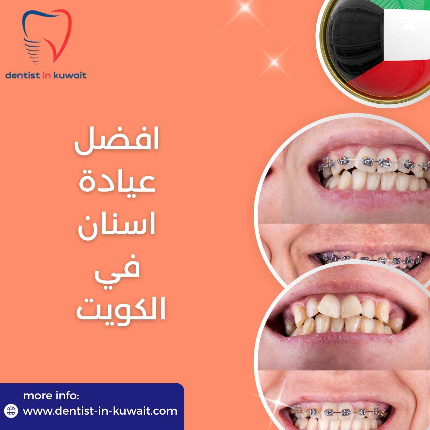 افضل عيادة اسنان في الكويت