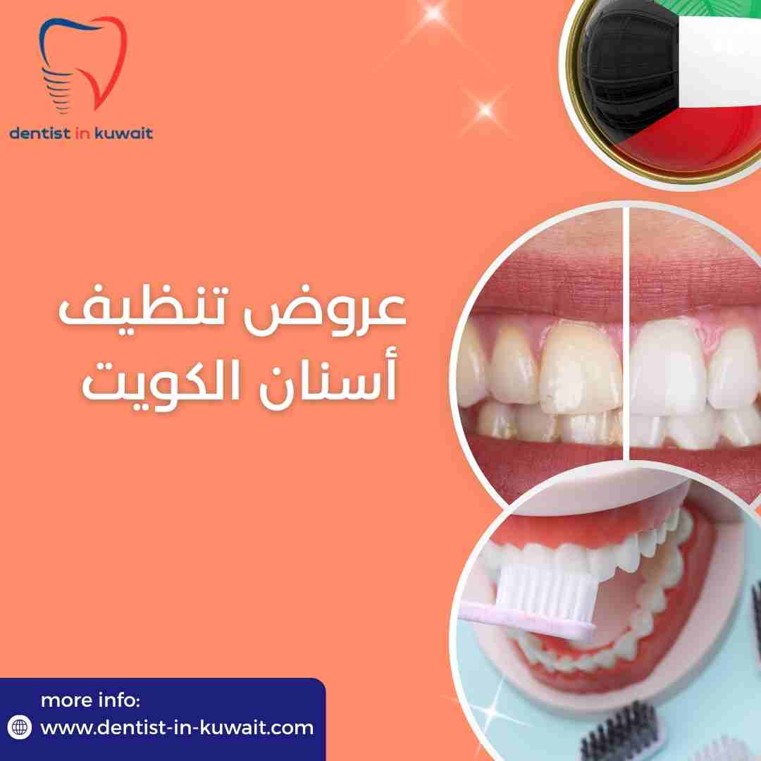 عروض تنظيف أسنان الكويت