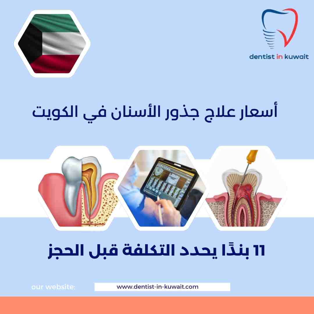 أسعار علاج جذور الأسنان في الكويت