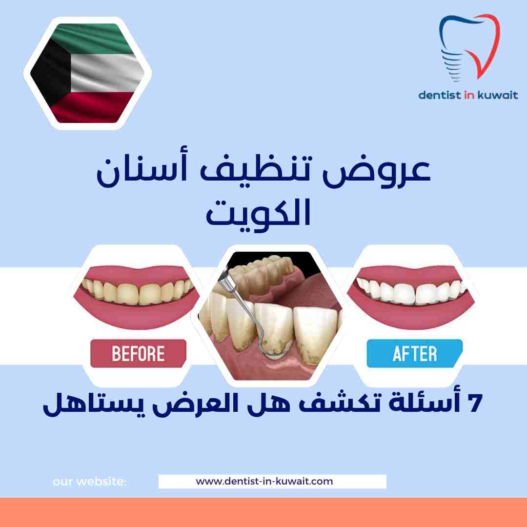 عروض تنظيف أسنان الكويت