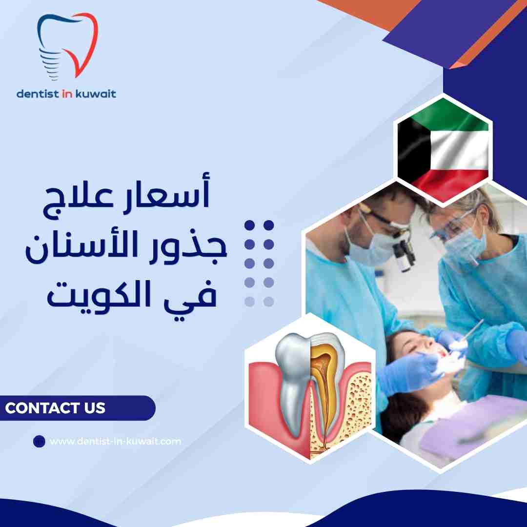 أسعار علاج جذور الأسنان في الكويت