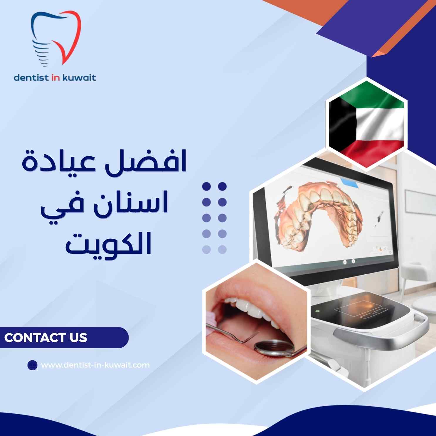افضل عيادة اسنان في الكويت