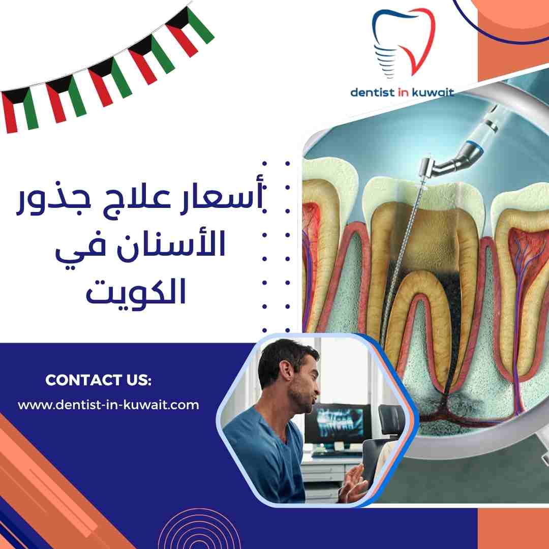 أسعار علاج جذور الأسنان في الكويت