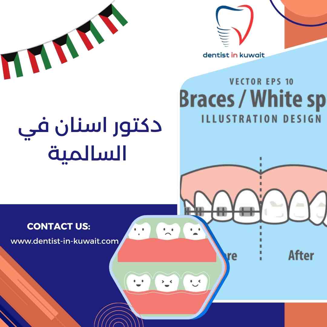 دكتور اسنان في السالمية