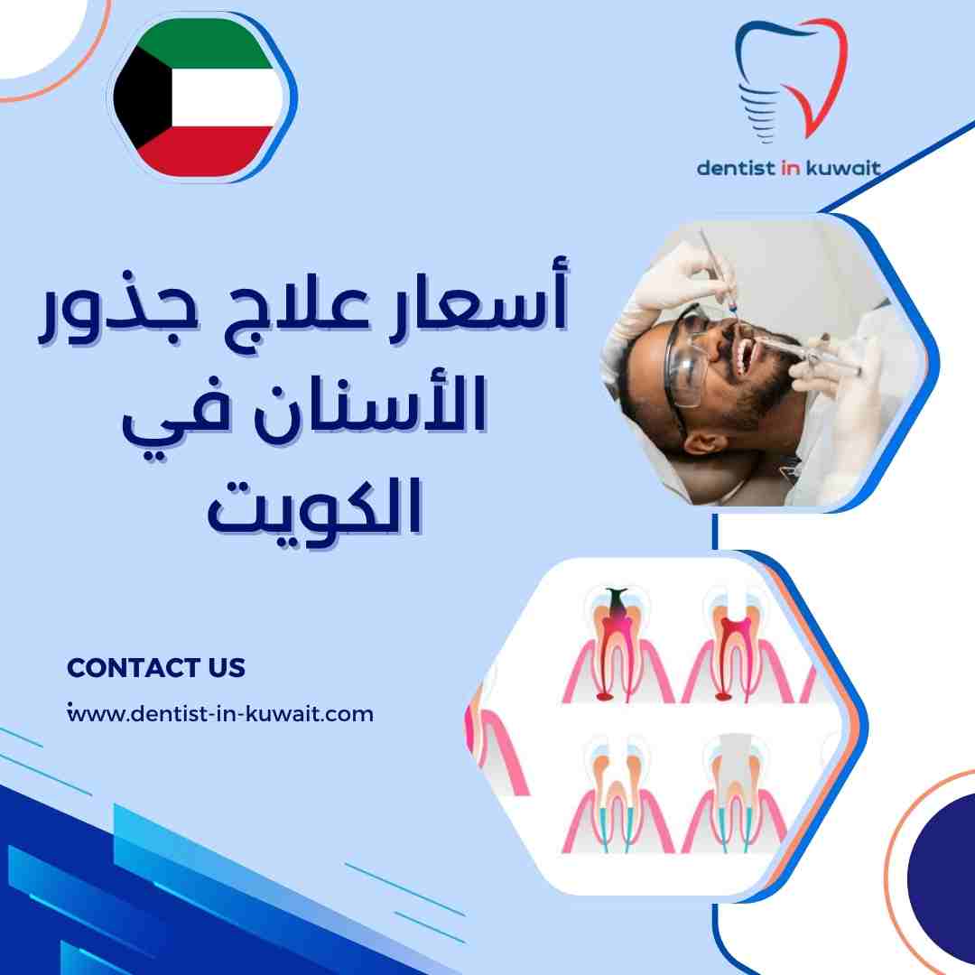 أسعار علاج جذور الأسنان في الكويت