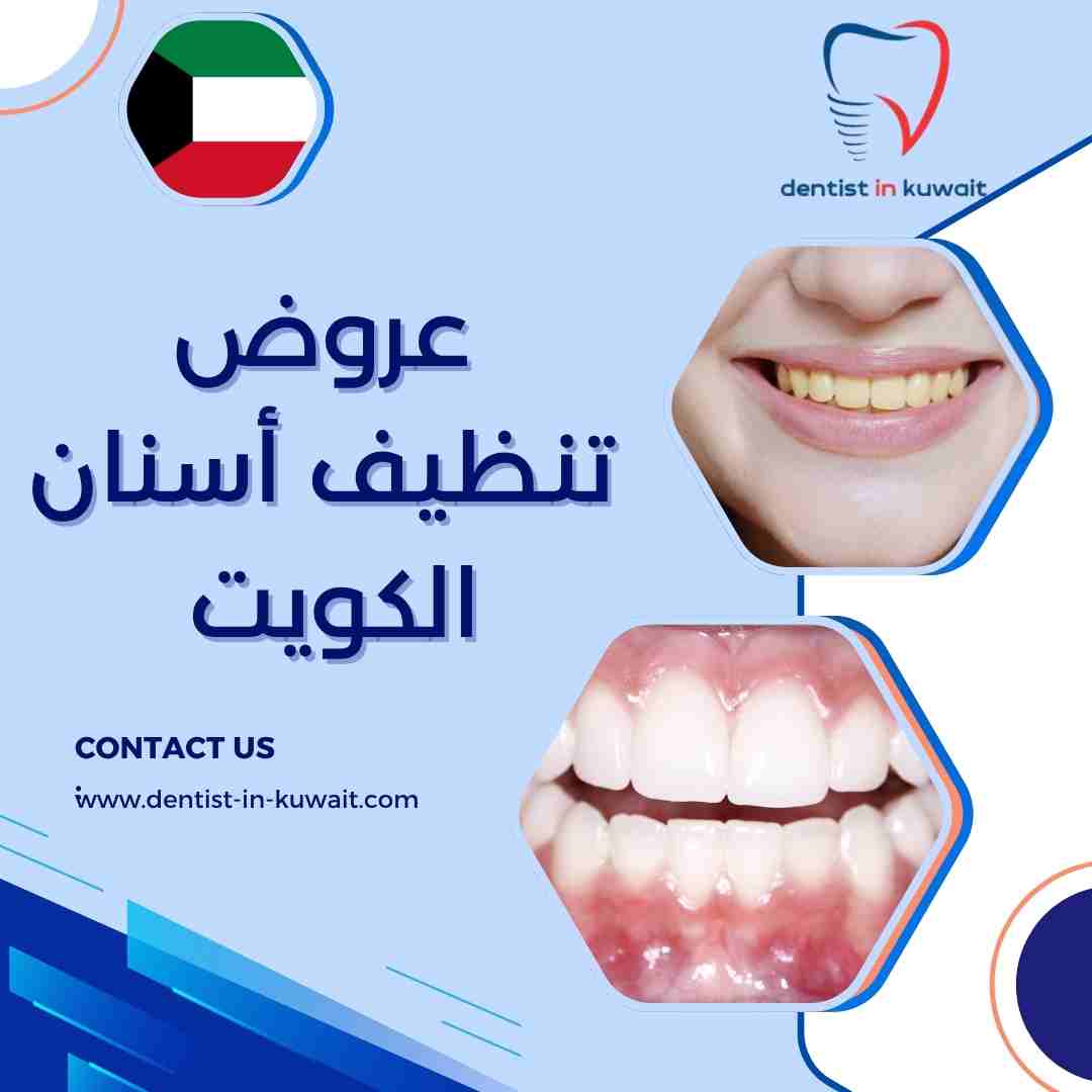 عروض تنظيف أسنان الكويت