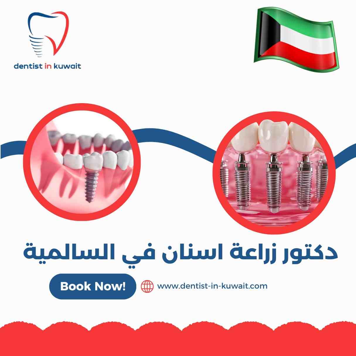 دكتور زراعة اسنان في السالمية