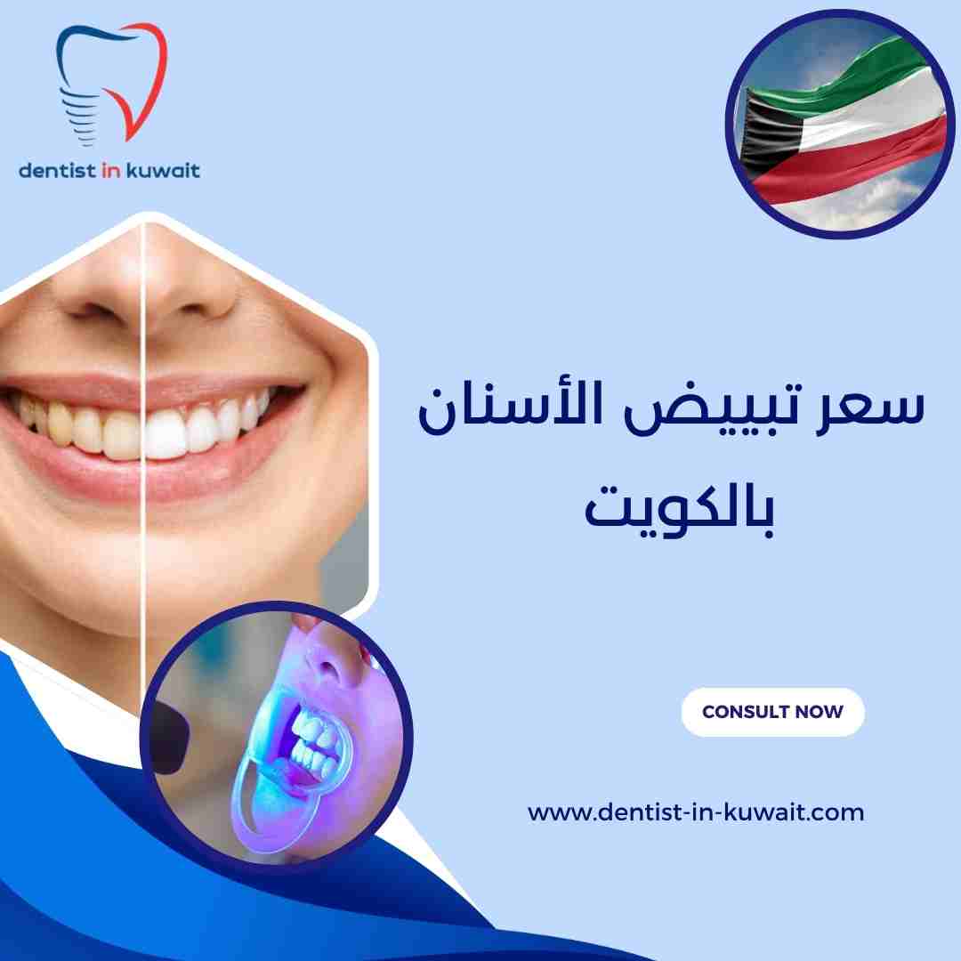 سعر تبييض الأسنان بالكويت