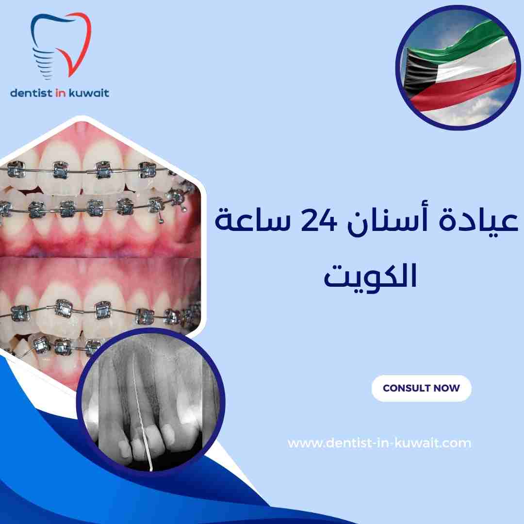 عيادة أسنان 24 ساعة الكويت