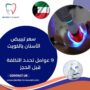 سعر تبييض الأسنان بالكويت