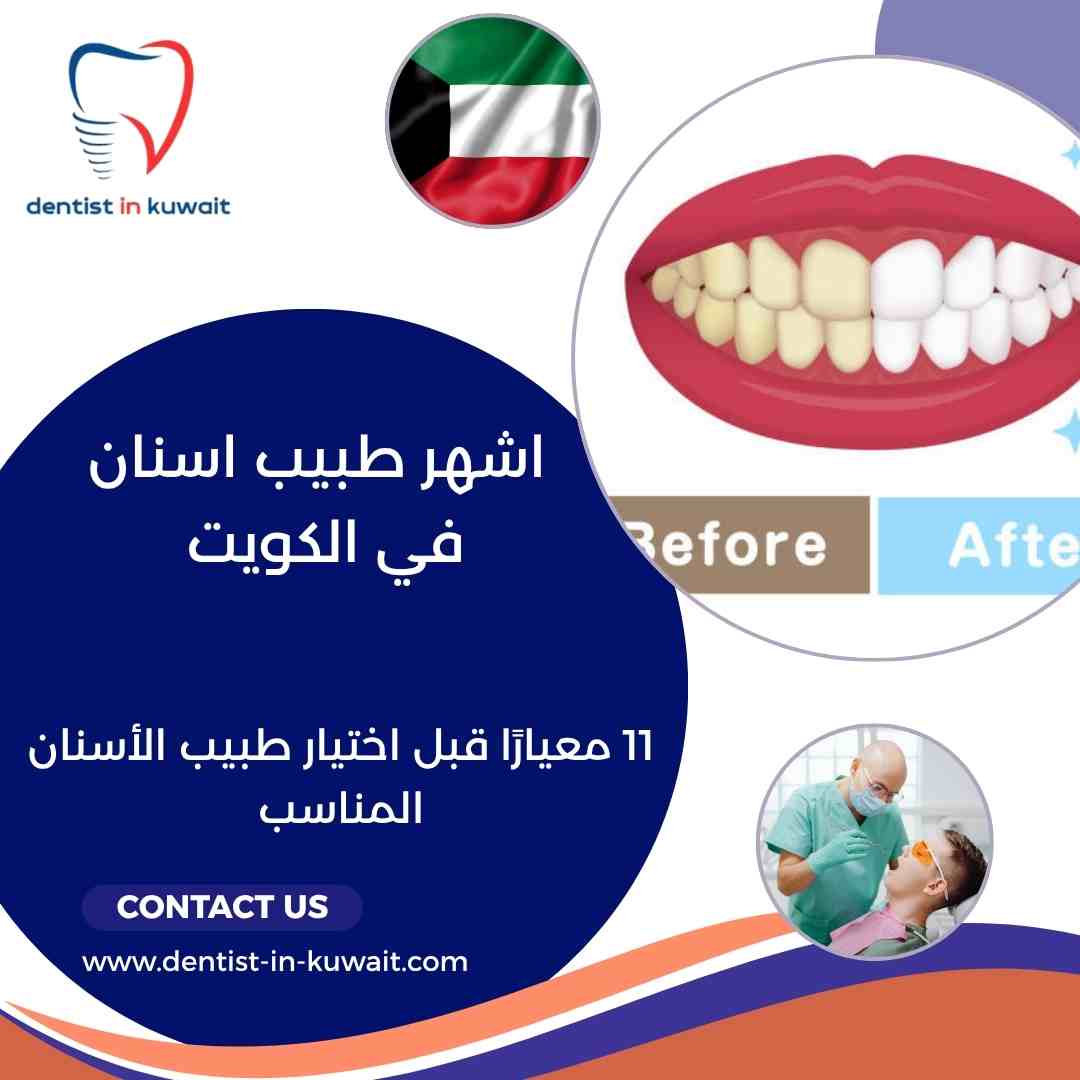 اشهر طبيب اسنان في الكويت