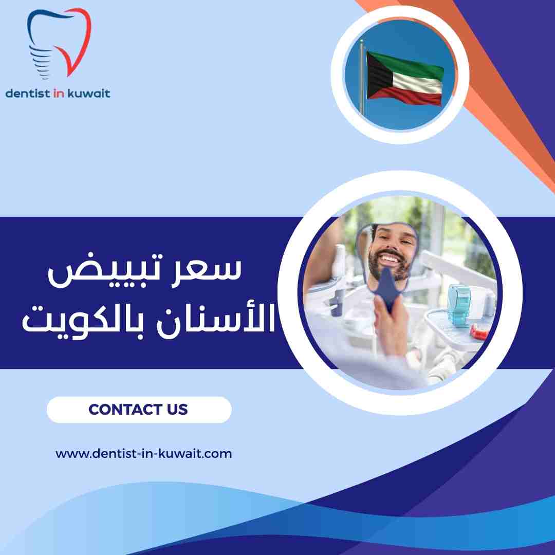 سعر تبييض الأسنان بالكويت