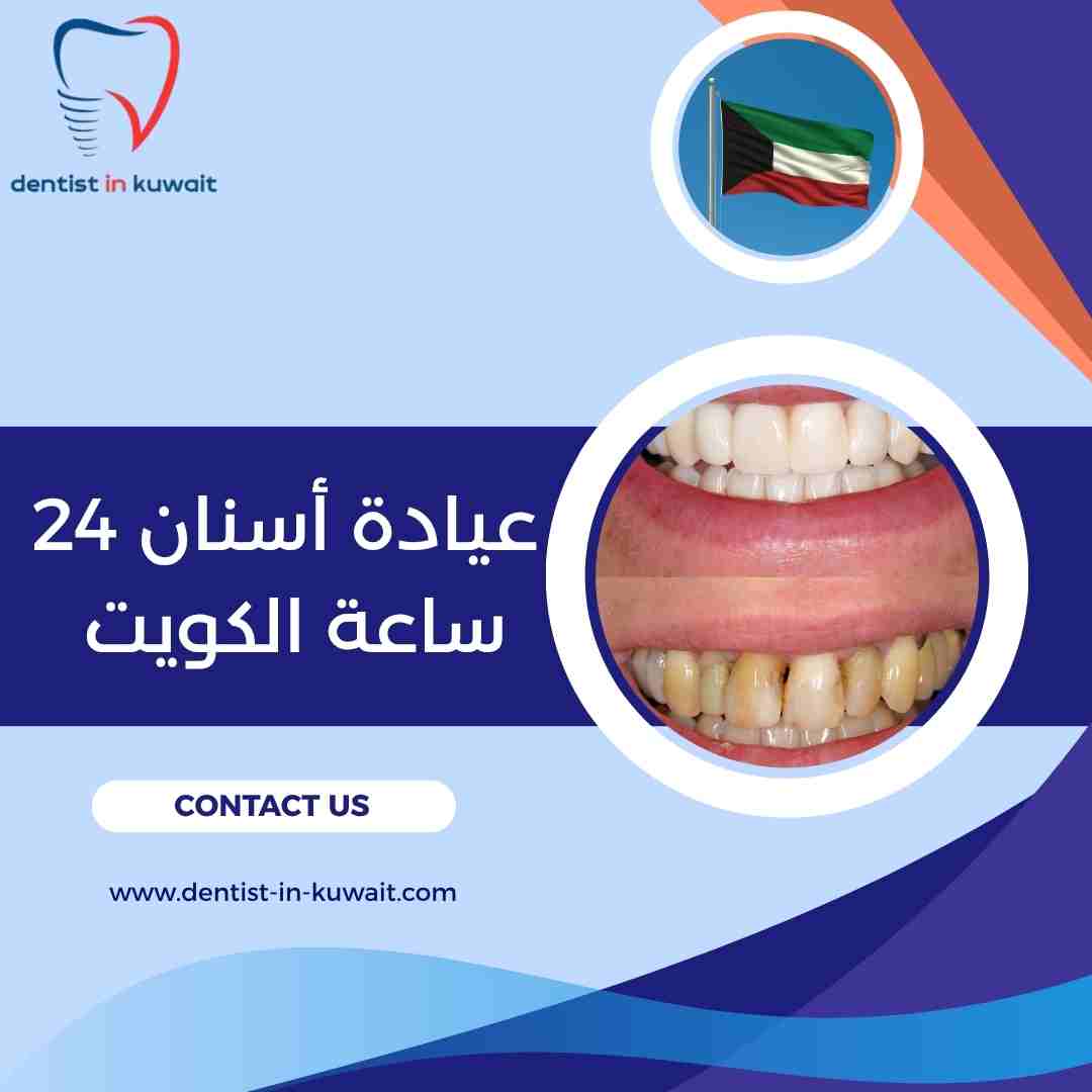 عيادة أسنان 24 ساعة الكويت
