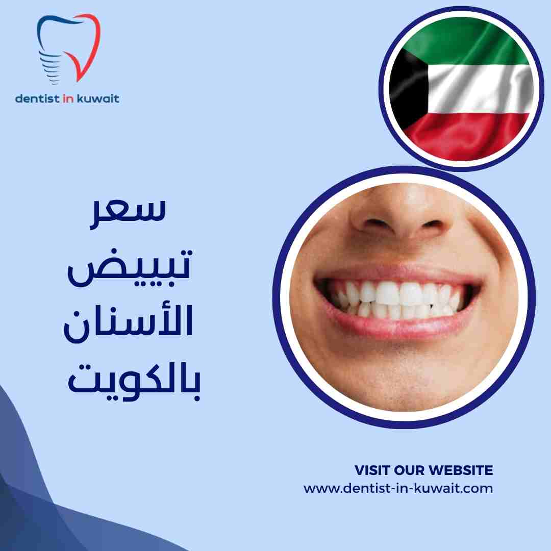 سعر تبييض الأسنان بالكويت