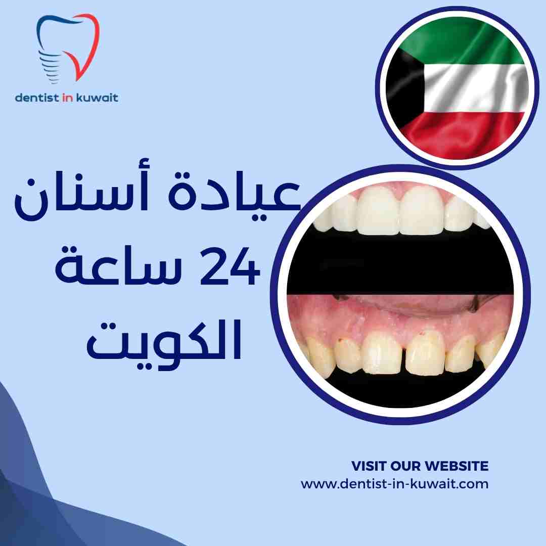 عيادة أسنان 24 ساعة الكويت