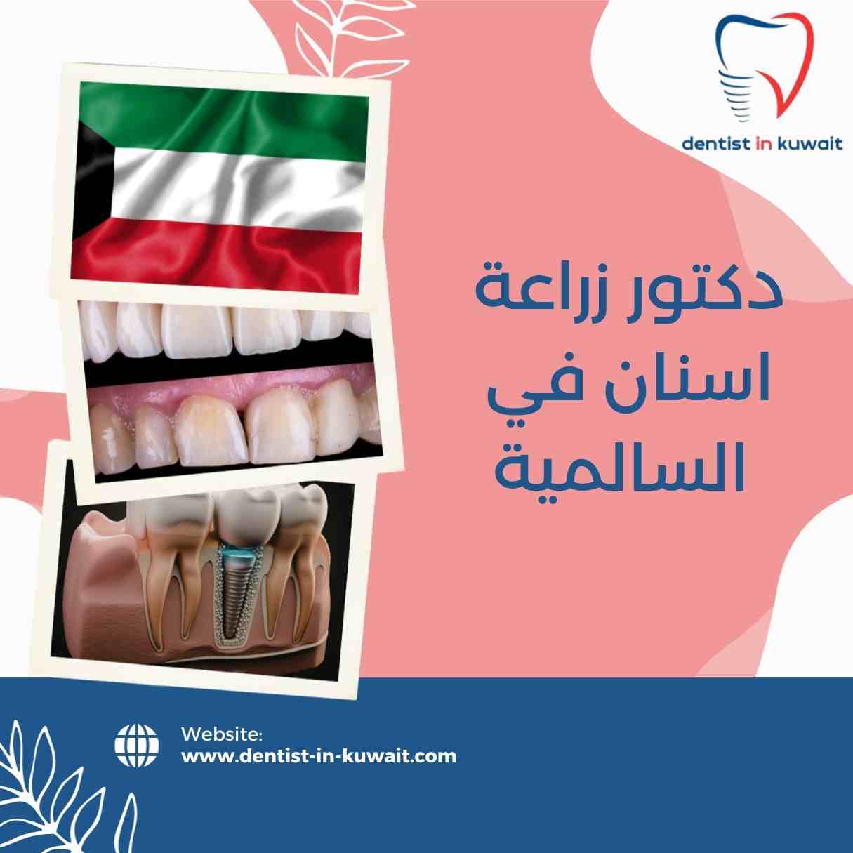 دكتور زراعة اسنان في السالمية