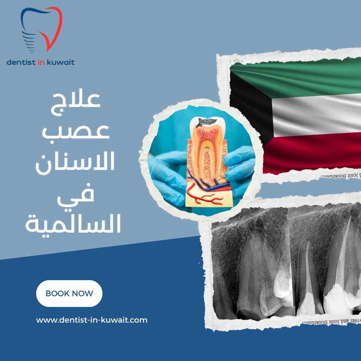 علاج عصب الاسنان في السالمية
