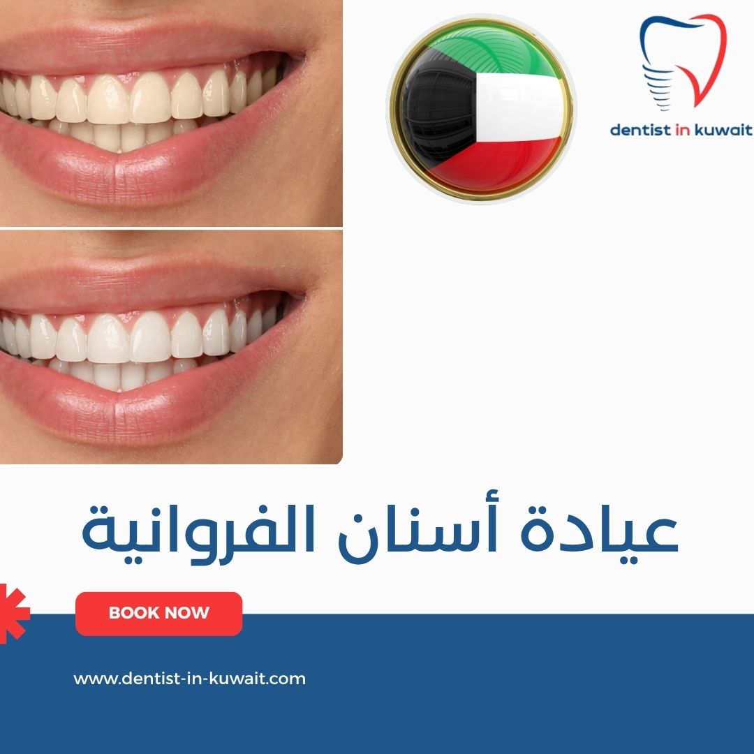 عيادة أسنان الفروانية